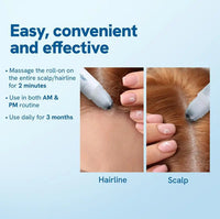 Hair BallEssence Be-Bodywise 3 Rosemary Hair Growth