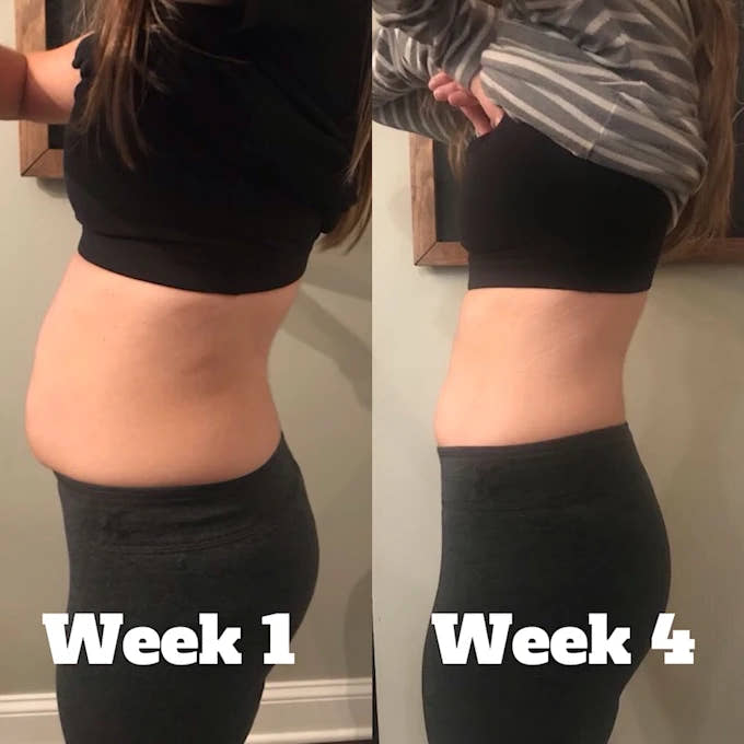 Mivya Lymphatic Drainage